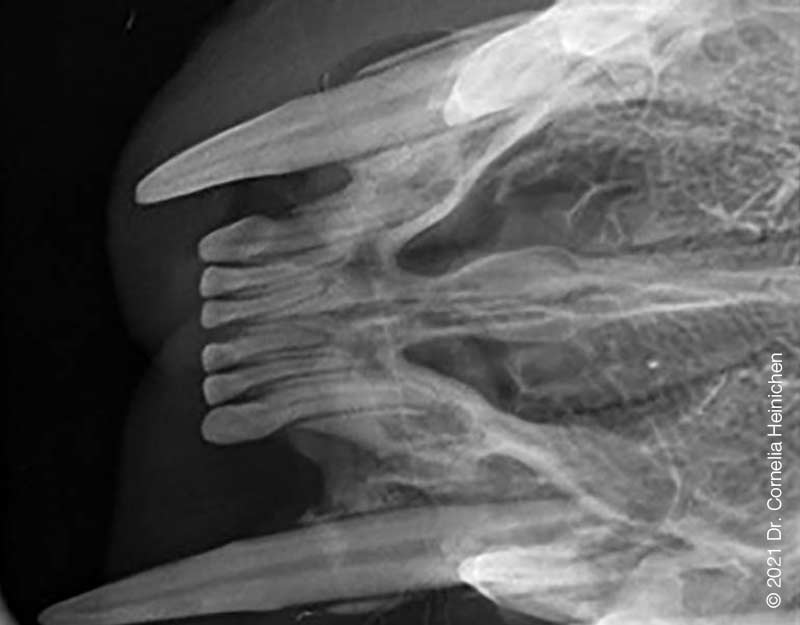 Horizontaler Knochenabbau des Unterkieferknochens mit deutlichen Umbauvorgängen im Zahnwurzelbereich
