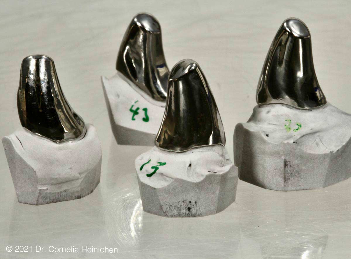 Metallkronen für Fangzähne
